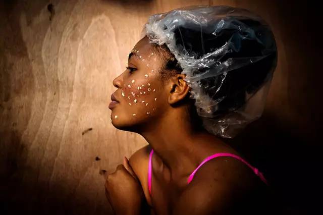 “我想变白，这样就会有更多男人来追我”