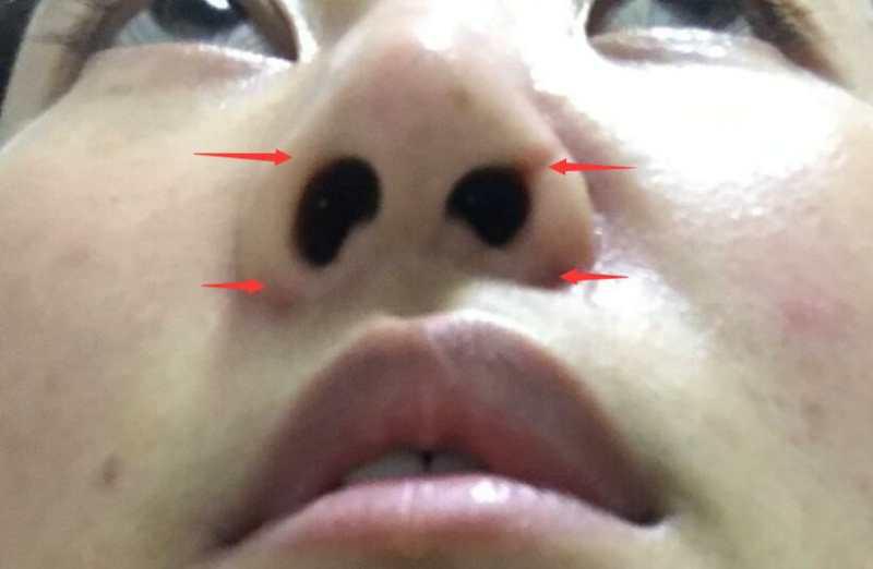 丽江被打毁容女游客视频,女游客丽江被打毁容案