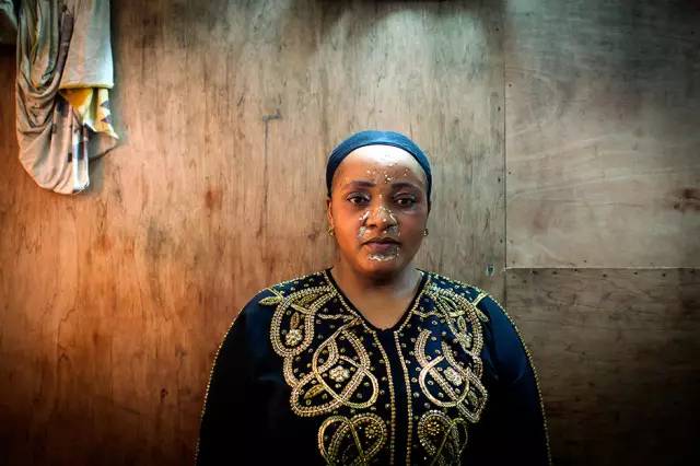 “我想变白，这样就会有更多男人来追我”