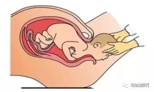 孕妇医院急诊门口站着生下宝宝,产科医生孕妇生小孩