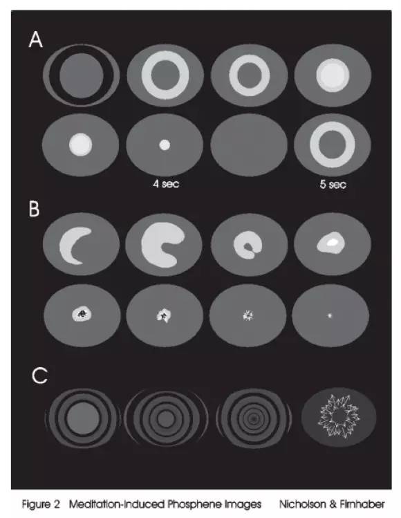 出现幻视怎么回事,老人幻视是怎么回事