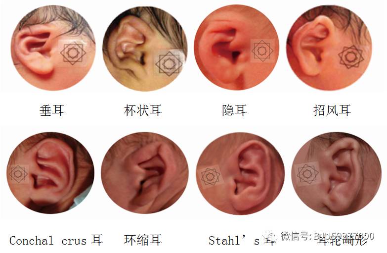 和睦的家庭孩子聪明,和睦家长