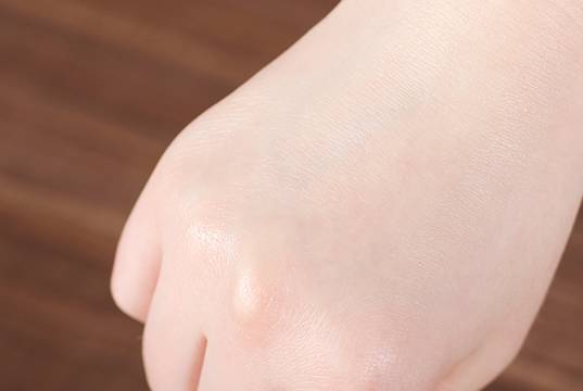 补水保湿排行榜10强玻尿酸,全球玻尿酸10大品牌排行榜