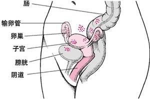 痛经的你要小心这六种疾病,痛经淤堵看过来