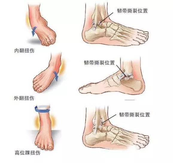 脚踝冷怎么保护,护脚踝防止脚踝过凉