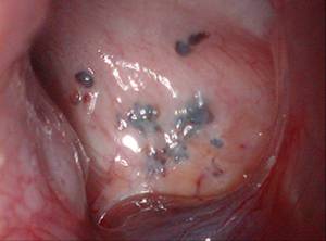 痛经的你要小心这六种疾病,痛经淤堵看过来