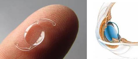 牙齿有金属填充物能不能做磁共振,做磁共振身上带金属会伤害身体吗