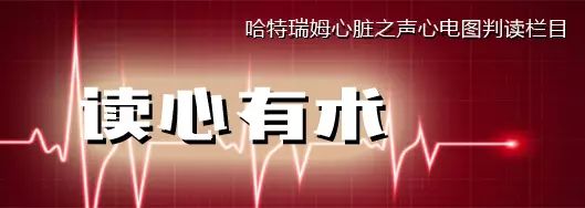读心有术205期视频,读心有术
