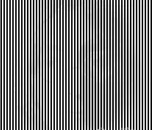 高度近视有时会突然看清怎么回事,高度近视会导致失明图片