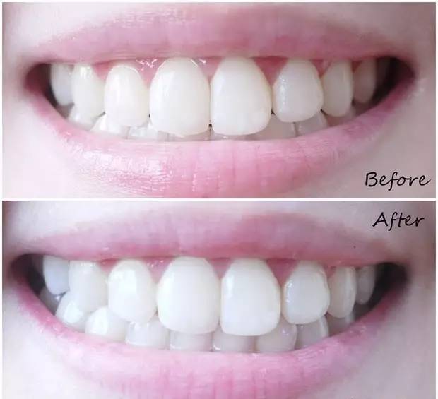 鍒氮璐规鼎鍞囪啅,鍒氮璐归挶涔板寲濡嗗搧