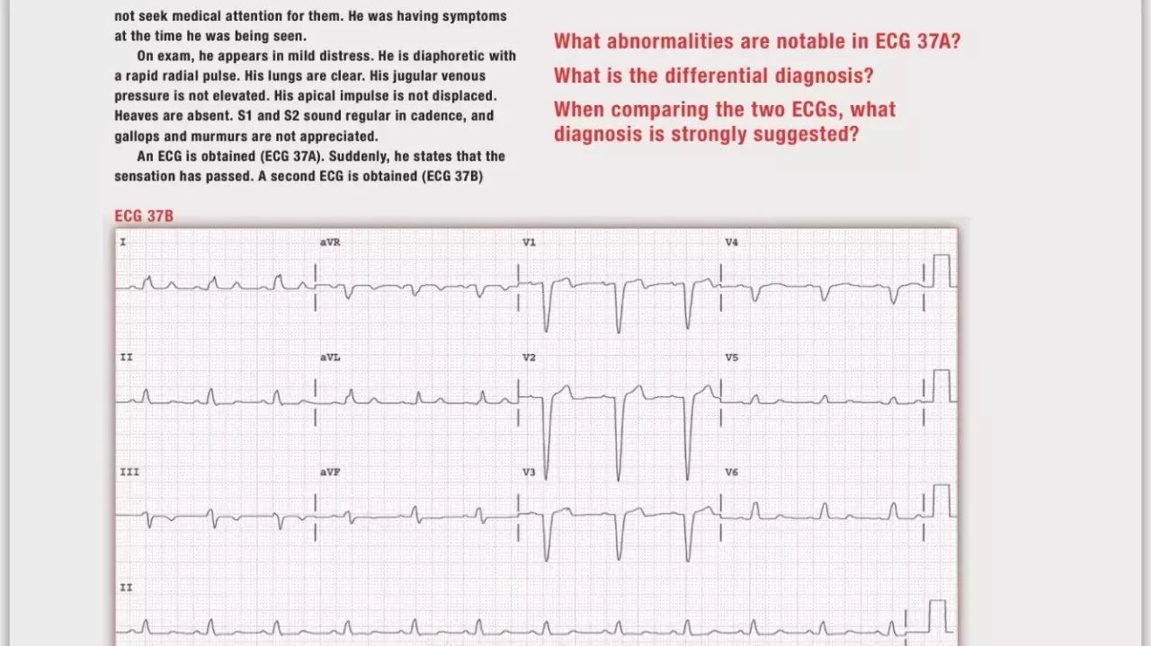 读心有术205期视频,读心有术