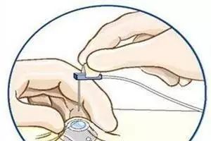 杈撴恫娓澏褰㈤拡绌垮埡瑙嗛,杈撴恫娓澏缈奸拡绫诲瀷