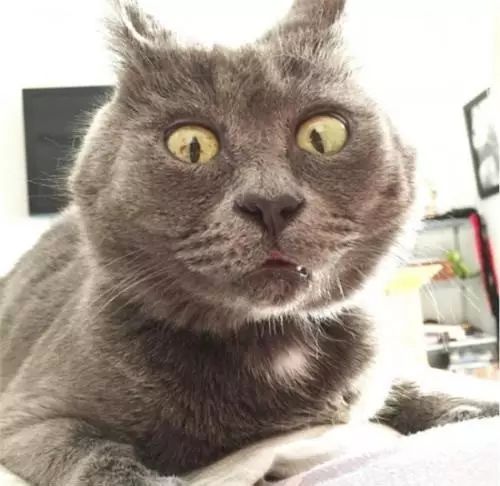 小疖子,有时可能也会要命!