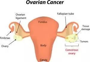妇女常见病普查工作,广州妇女最新消息