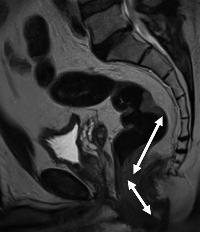 记住一个单词的一般方法,记住癌症九字诀