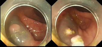 消化内镜都是消化内科医生做的吗,消化内科医生做内镜吗