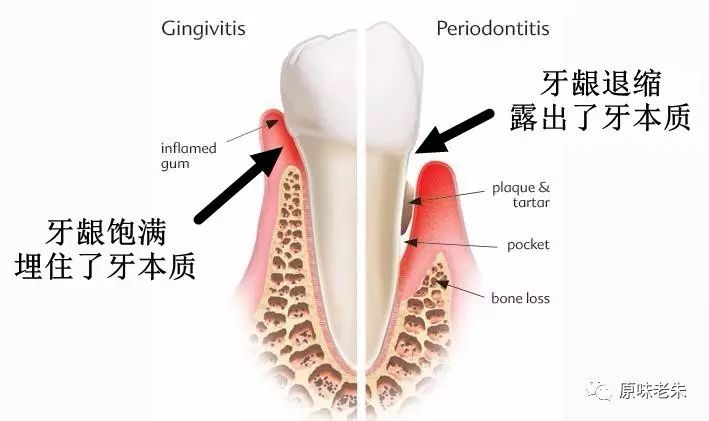 920爱牙日·牙齿酸软请心疼自己,80%的解决办法都在这里了,请自取