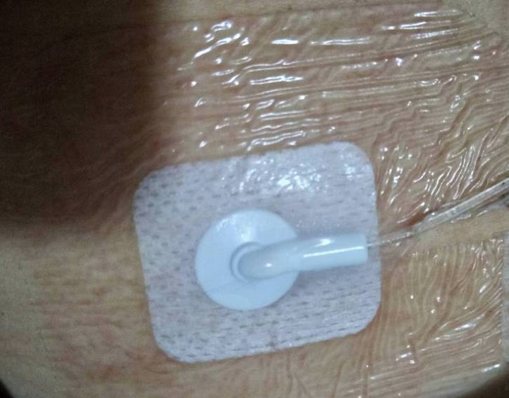 血糖飙到18会怎样,血糖飙到二十多怎么办