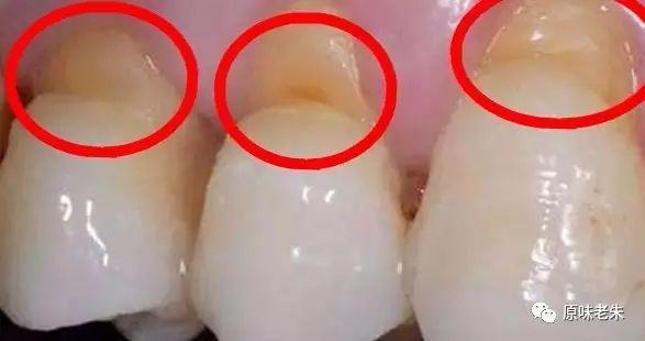 920爱牙日·牙齿酸软请心疼自己,80%的解决办法都在这里了,请自取