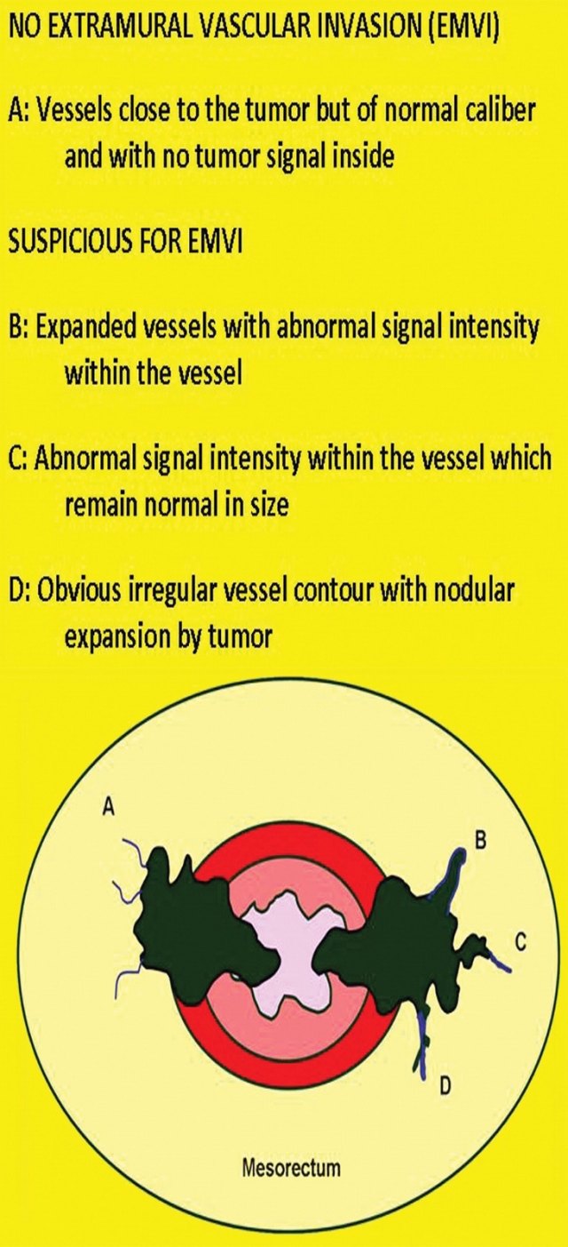 记住一个单词的一般方法,记住癌症九字诀