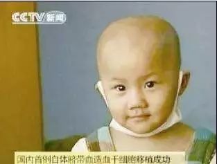 战胜肿瘤的十个方法,脐带血治疗肿瘤的新方法