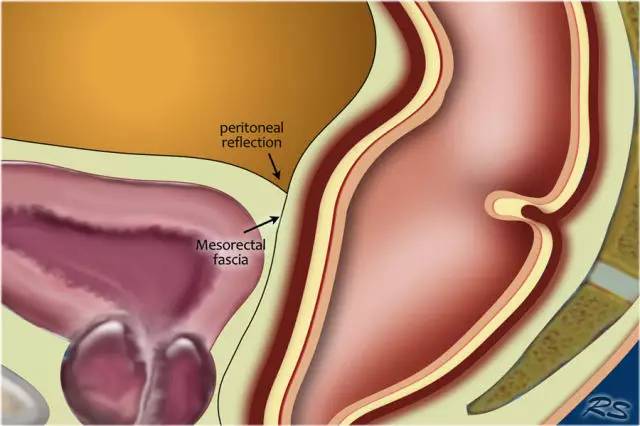 记住一个单词的一般方法,记住癌症九字诀