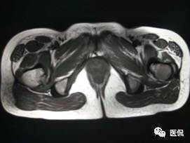 髋部疼痛做什么检查,左髋部疼痛待查病例