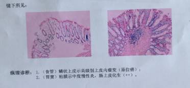 消化内镜都是消化内科医生做的吗,消化内科医生做内镜吗