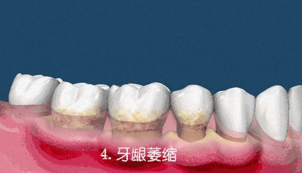 「爱牙日」牙龈出血、口腔异味、牙龈发炎……广东省中医院口腔科的这些“明星制剂”或能帮到您