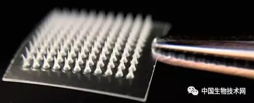 减肥贴的正确方式,减肥要贴什么穴位