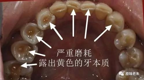 920爱牙日·牙齿酸软请心疼自己,80%的解决办法都在这里了,请自取