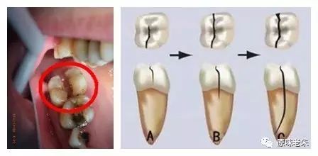 920爱牙日·牙齿酸软请心疼自己,80%的解决办法都在这里了,请自取