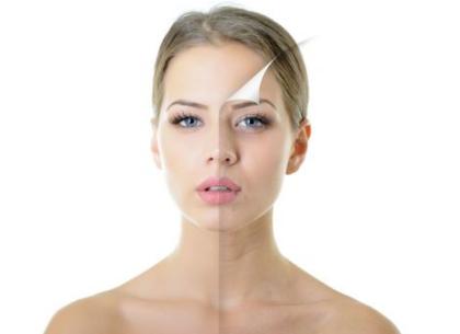 清洁面膜能去除粉刺吗,哪种清洁面膜去粉刺好