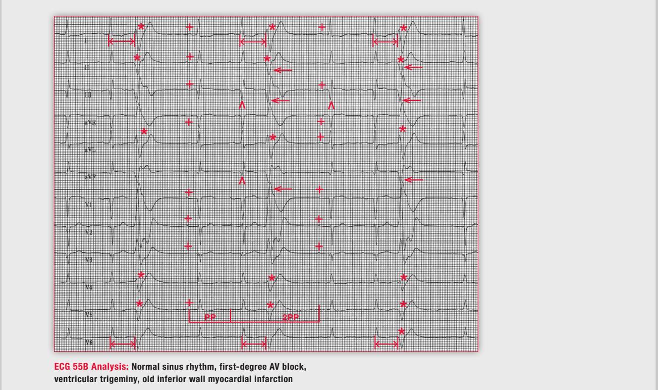 读心有术150期,读心术169