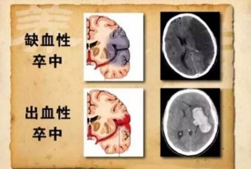 男性起床头晕是怎么回事,晚上起夜后头晕是什么原因