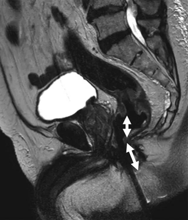 记住一个单词的一般方法,记住癌症九字诀