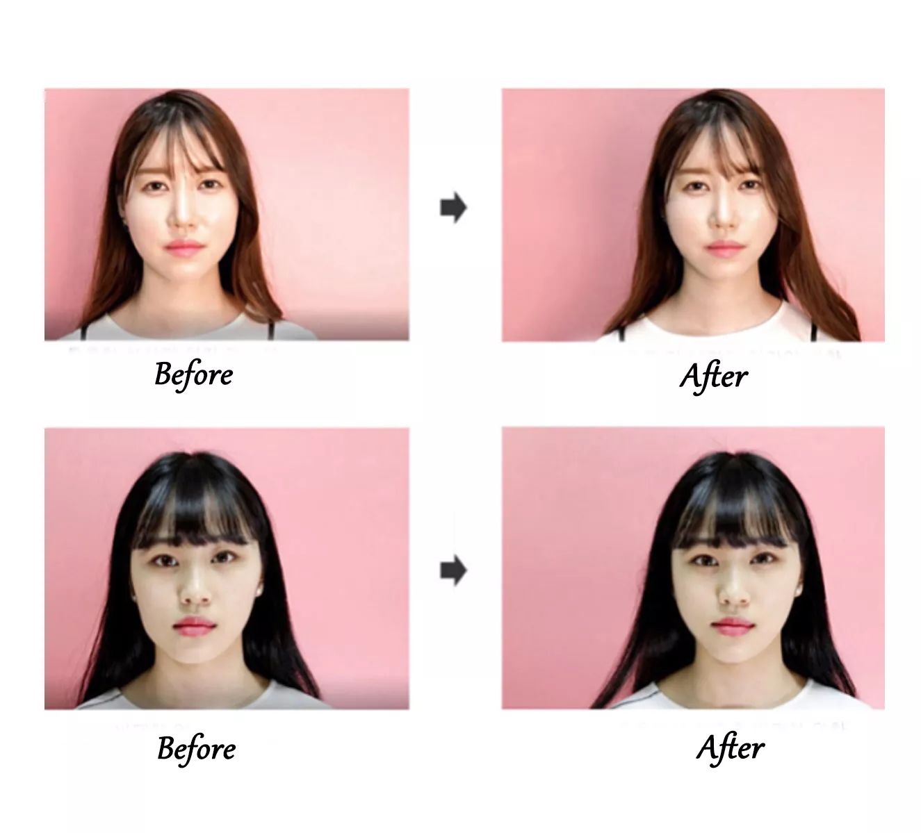 瘦脸不要跟风,瘦脸不走捷径是不可能的