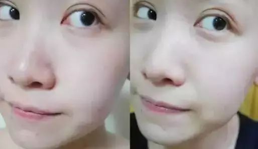 压力山大的时候要如何调整皮肤状态？