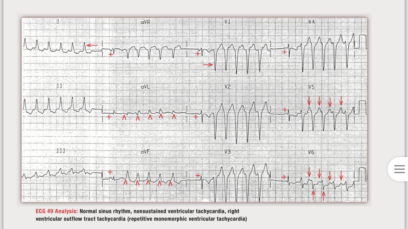 《读心有术》,读心有术265
