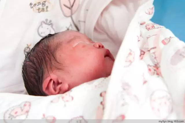 剖腹产全景记录,剖腹产恢复不同时期的照片