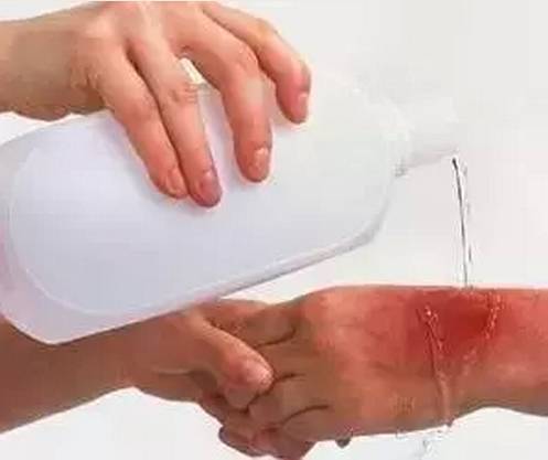 小舒答疑丨烧伤后如何紧急处理？抹牙膏靠谱吗？