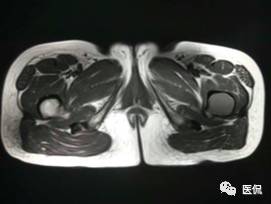 髋部疼痛做什么检查,左髋部疼痛待查病例