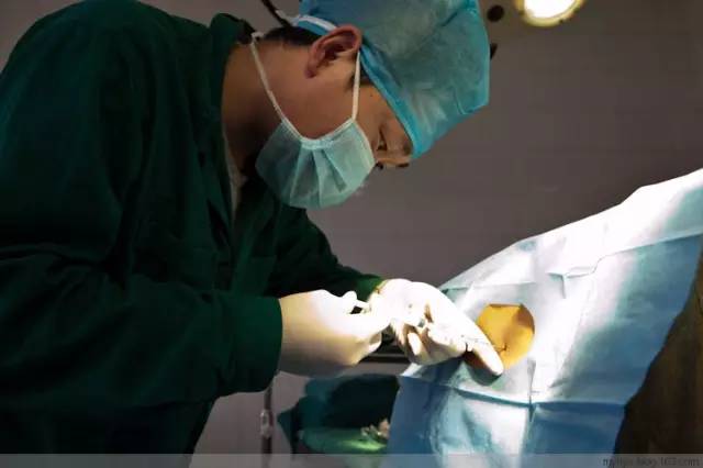 剖腹产全景记录,剖腹产恢复不同时期的照片