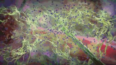 美容利器，竟然也是癌症帮凶！这帮科学家靠消灭体内玻尿酸治疗癌症，一日拿下20亿美元订单｜奇点实力派