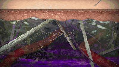 美容利器，竟然也是癌症帮凶！这帮科学家靠消灭体内玻尿酸治疗癌症，一日拿下20亿美元订单｜奇点实力派