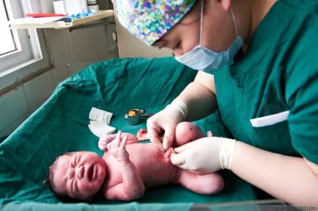 剖腹产全景记录,剖腹产恢复不同时期的照片