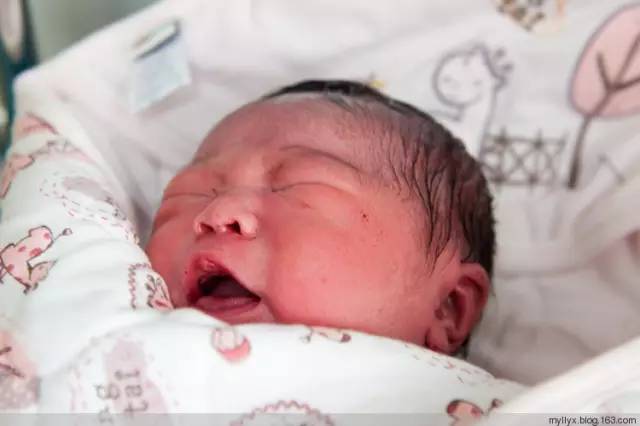 剖腹产全景记录,剖腹产恢复不同时期的照片