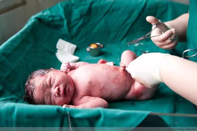 剖腹产全景记录,剖腹产恢复不同时期的照片