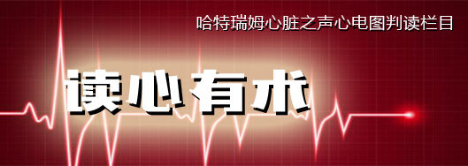 读心有术讲的是什么,读心有术