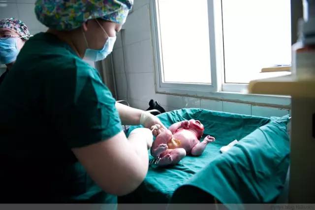 剖腹产全景记录,剖腹产恢复不同时期的照片